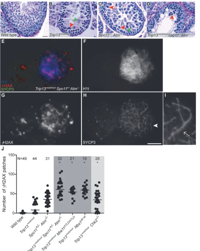 Fig 2. Trip13 mod/mod Spo11 +/− Atm −/− spermatocytes arrest at epithelial stage IV, but present autosomal asynapsis, multiple unrepaired DSBs and fail to form a sex body at mid/late pachynema