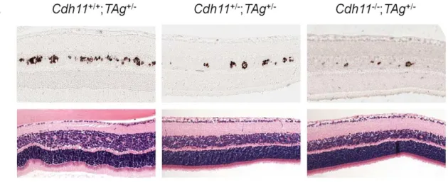 Figure 6. At PND28, fewer multifocal tumors developed when Cdh11 alleles were lost. (A) A distinct Cdh11 loss phenotype was observed from representative sections of TAg and H&amp;E stains