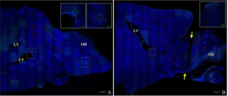 Figure 1. Mouse brain composite image illustrating olfactory bulb transection. Images were obtained on a Nikon confocal microscope using a 206 objective and reconstructed into a composite image using ImageJ MosaicJ