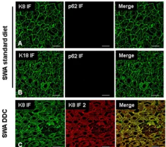 Figure 4. isPLA for 12 week-DDC treated mice. Images (A, B) show isPLA signal (red) using ABs to p62 and K8 (A) and p62 and K18 (B)