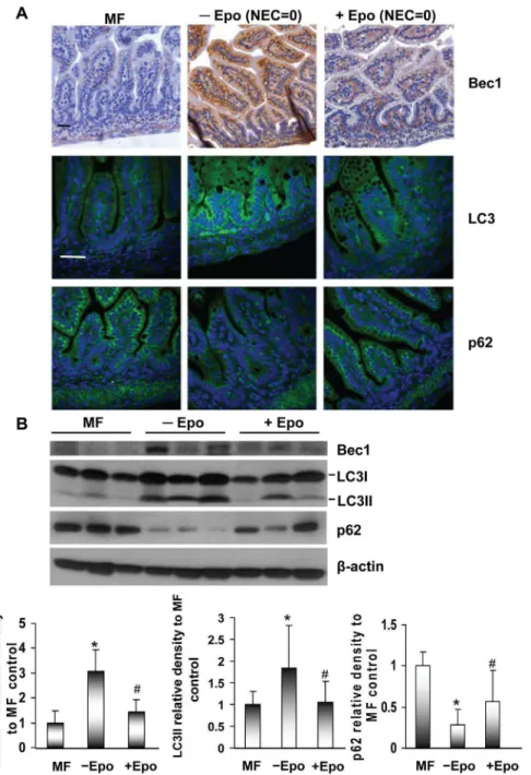 Figure 3. Effect of Epo on Beclin 1, LC3 and p62 expression in ileum of experimental NEC rats
