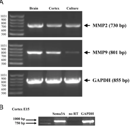 Figure 2. Expression of MMP2 and MMP9 in cortical neurons. (A) RT-PCR analysis of MMP2 and MMP9 transcripts in E15 whole brain, E15 whole cortex and dissociated E15 cortical neurons after 2 day in culture