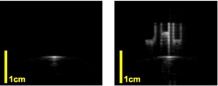 Figure 15. The B mode image of arbitrary pattern injection. The experiment is in a water tank with Sonix CEP machine and L12-5 linear probe