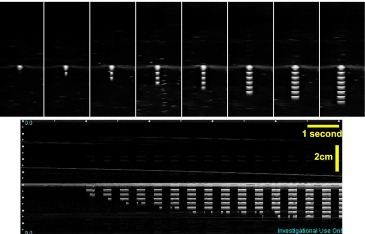 Figure 17. In vivo B-mode images extracted from the 3D volumetric data. The imaging array scans perpendicularly to the image plane with a step size of 0.5 mm