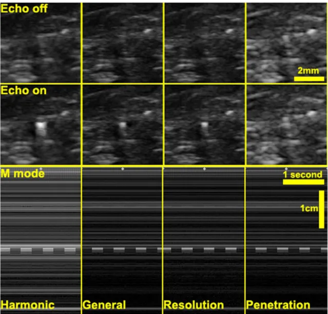 Figure 13. The B-mode and M-mode image of active echo spot using different imaging methods