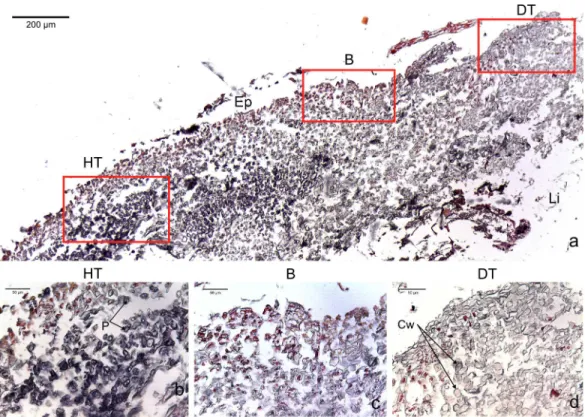 Figure 2 Transversal histological sections of the CCA, Paragoniolithon solubile affected by CWBS stained in Sharman’s (1943) stain