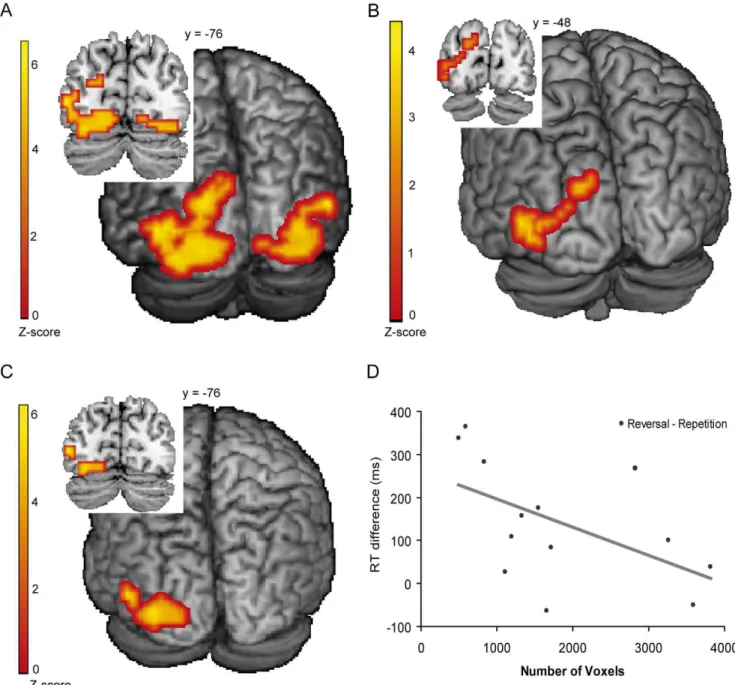 Figure 4. fMRI results from the verb generation task and reorganization analysis. (A) Difference between blind and sighted individuals for the contrast word 