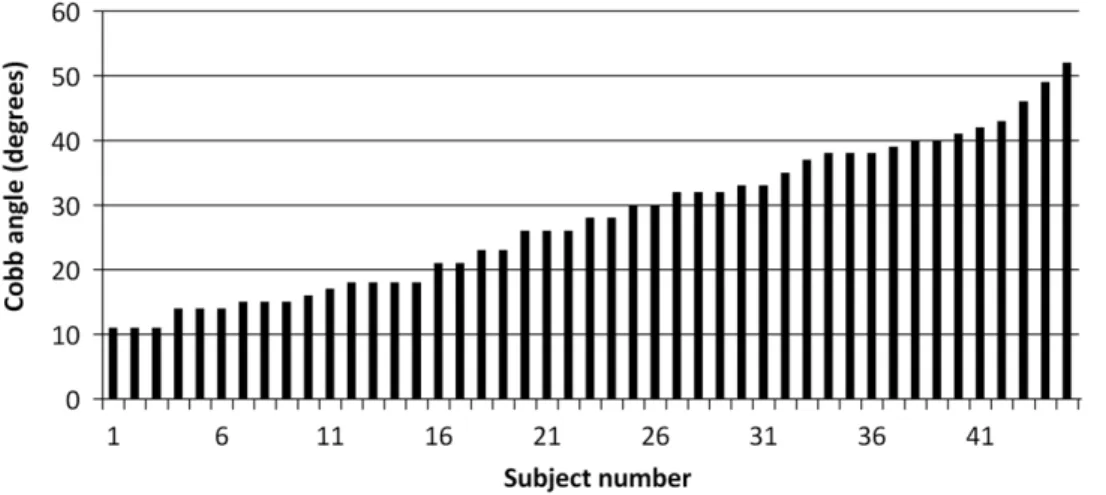 Table 1. Mean values and standard deviations for age, height, mass and Cobb angle and range are given for the moderate and severe scoliosis groups.