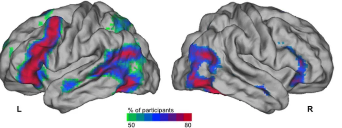 Figure 3. Probability map of the right-handed participants having a significant activation during sentence generation (SENT) as compared to recitation of a list of overlearned words (LIST) in the subgroup of 144 right-handers