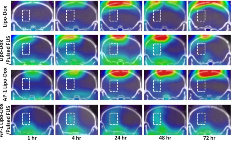 Figure 2 reveals that the tumor-to-contralateral brain ratios derived from the dynamic SPECT images of the tumors are