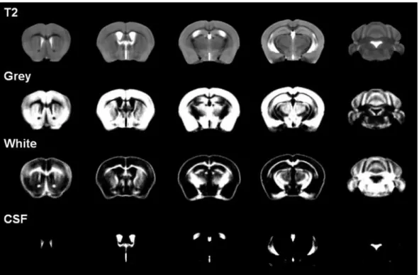Figure 3. Average T2 image and segmented tissue maps of all the mice used in this study.