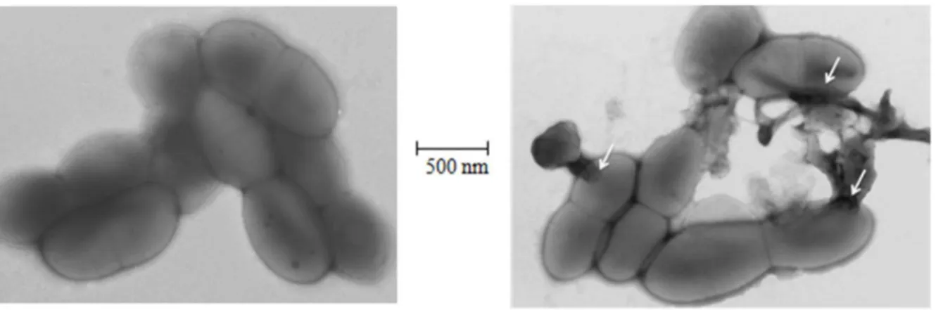 Figure 3. Images by electron microscopy demonstrating the morphological effects of squalamine on M