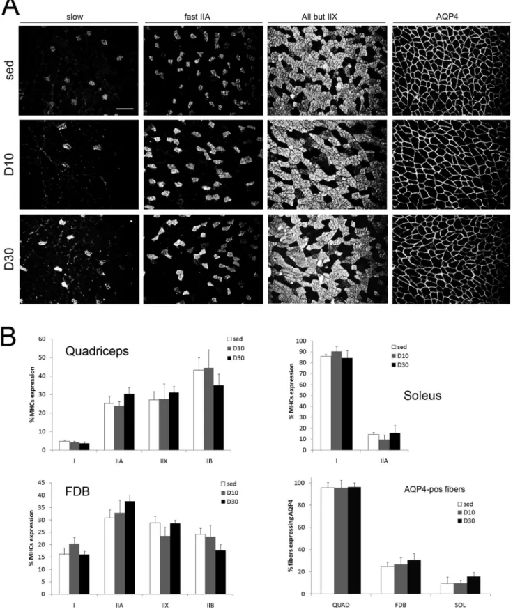 Figure 3. MHCs distribution in rat quadriceps muscles after treadmill activity. A) Representative immunofluorescence photomicrographs of MHC isoforms and AQP4 in quadriceps muscle from sed, D10 and D30 rats groups