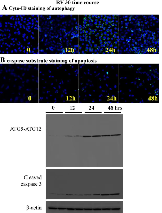 Fig 8. The time course of autophagy and apoptosis induction by 30 μM resveratrol treatment