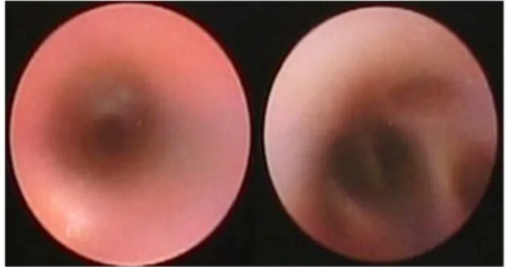 Figure 3. Real-time imaging provides peripheral bronchial intraluminal information and peripheral bronchial branches in a healthy canine.