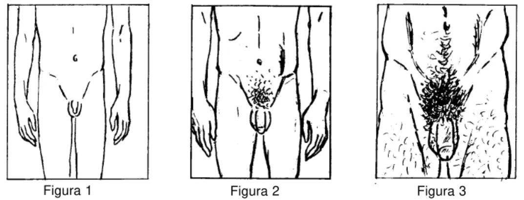 Figura 1 Figura 2 Figura 3