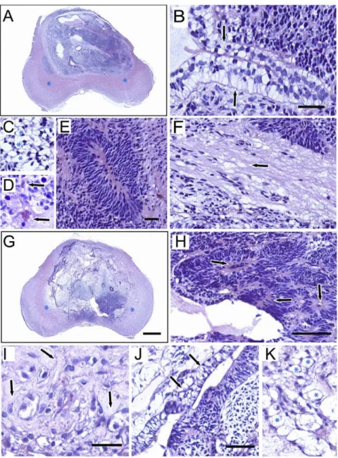 Figure 6. In vivo differentiative capacity of hESCs upon extended passaging after sorting with Y-27632
