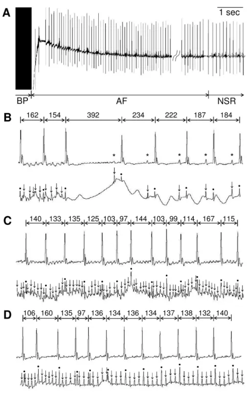 Fig 1. Induction of AF by transesophageal atrial burst pacing in mice. Representative lead II body surface electrocardiogram (ECG) recordings (A)