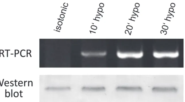 Fig 6. Hypotonic stress-induced upregulation of SLC5A3 at the mRNA and protein level in HEK293 cells revealed by semiquantitative RT-PCR and Western blot, respectively