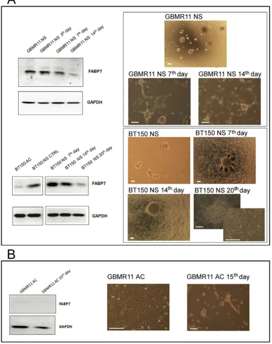Figure 3. Impact of cell culture conditions on FABP7 protein expression. (A) Seven days after withdrawal of growth factors and addition of serum, FABP7 expression decreased together with the change in morphology from neurospheres to adherent cells