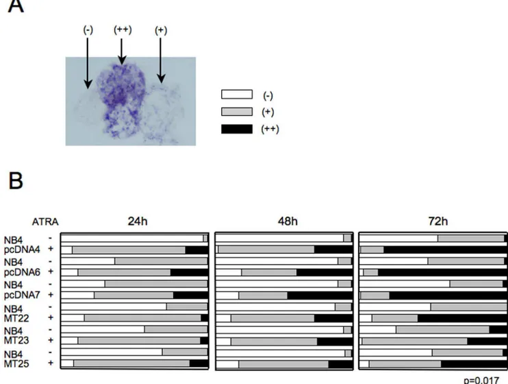 Figure 3. Changes in the cell cycle induced by ATRA in NB4MTOE cells. (A) Cell cycle profiles of NB4MTOE cells and their control cells in the presence (1 mM) or absence (solvent, ethanol) of ATRA for 72 h