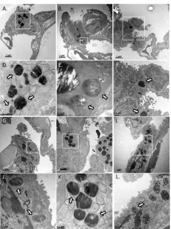 Fig 5. Electron microscopy images of Francisella tularensis strains within murine alveolar type II epithelial cells