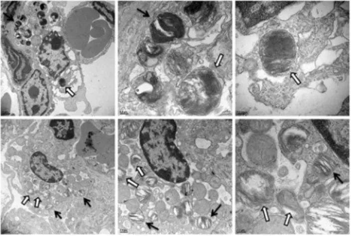 Fig 6. TEM of F. tularensis in dying AT-II cells in vivo. TEM images of infected mouse lungs at both 32 and 48 hpi infected with Schu S4