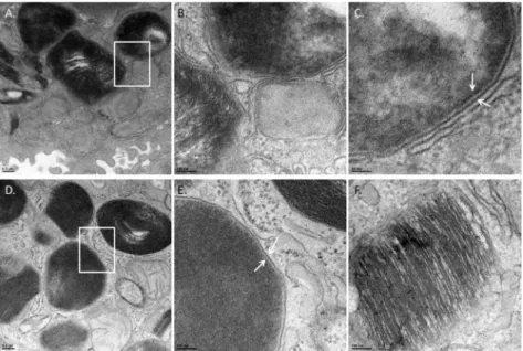 Fig 4. Identification of F. tularensis in AT-II cells. TEM images of infected mouse lungs at 24 hours post infection