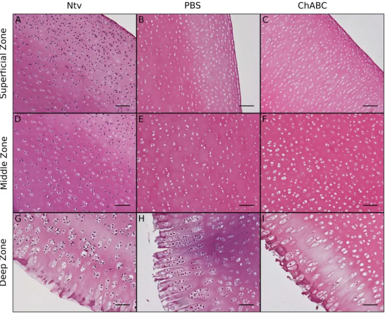 Fig 4. H&amp;E staining of longitudinal cross sections of decellularized cartilage. Compared to native cartilage (Ntv), both groups of decellularized cartilage contained less cellular material in the superficial, middle, and deep zones