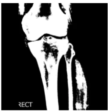 Figure 4: Thresholded Images 