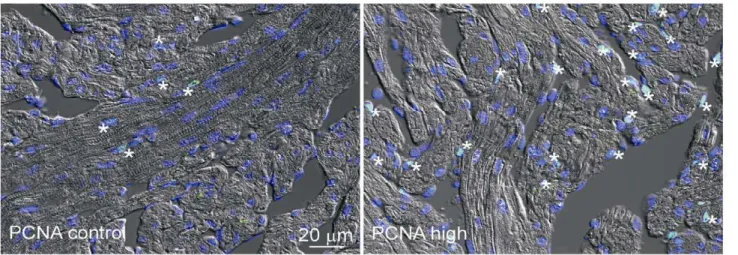 Figure 1. Exercise training and cardiomyocyte proliferation. Immunofluorescence detection of PCNA (green) in spongy myocardium