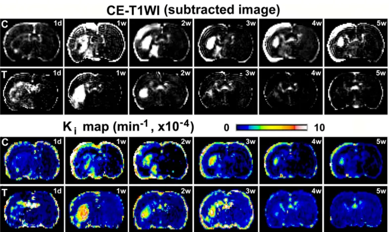 Fig 2. Evolution of BBB disruption by MRI. BBB disruption, with enhancement in the subtracted images of pre and post gadopentetate of CE-T1WI, persisted from 1w to 5w post stroke in saline treated, i.e., control, T2DM rat (C, the top row)