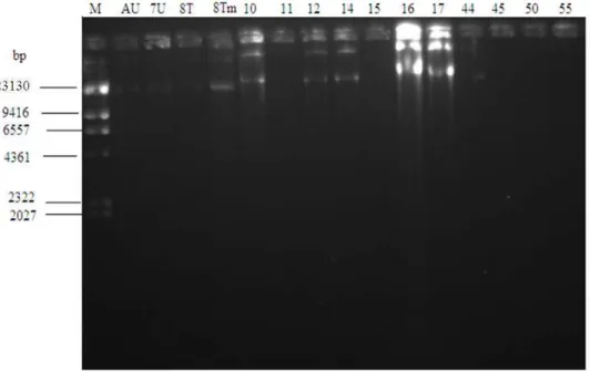 Fig. 2.  Showing the plasmids of the Acinetobacter isolates M- Molecular ladder to serve as ruler for the procedure