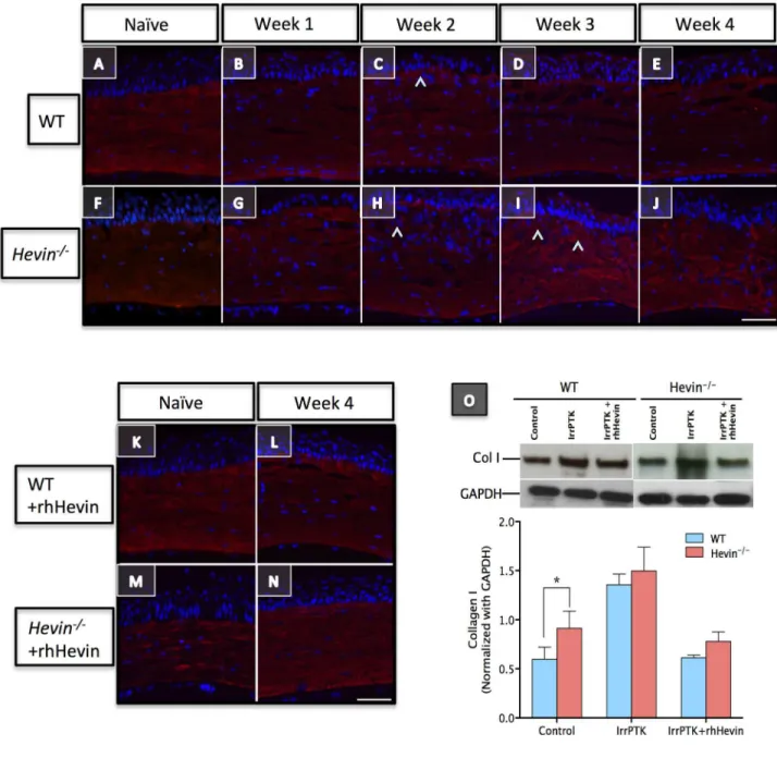 Figure 8.  Loss of hevin results in excessive accumulation of Collagen I and Collagen IV in corneal stroma