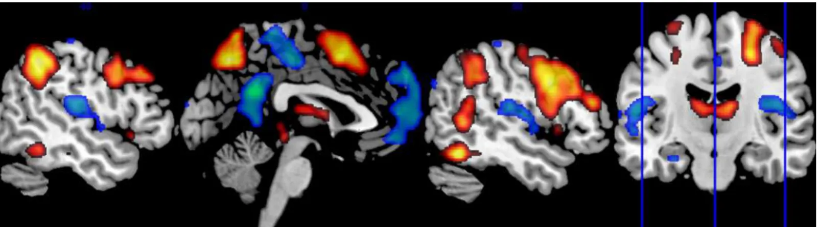 Fig 1. Positive and negative BOLD responses during executive processing. The sagittal brain images show whole brain group activation during the working memory task
