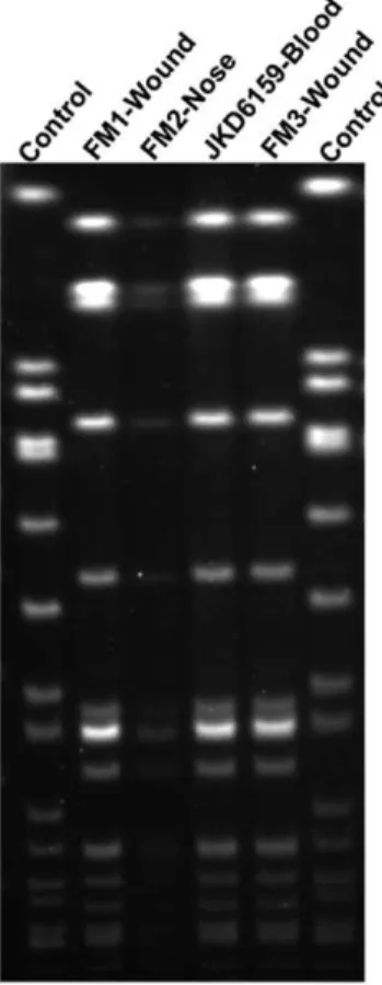 Figure 1. Sma I pulsed field gel electrophoresis analysis. PFGE of index isolate, S. aureus JKD6159 and isolates from three family members, FM1, FM2, FM3.