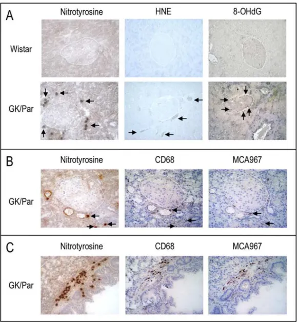 Figure 1. In 2.5-month-old diabetic GK/Par pancreases, nitrotyrosine, 4-hydroxy-2-nonenal (HNE)-modified proteins and 8- 8-hydroxy-29-deoxyguanosine (8-OHdG) accumulate in the peri-islet vascular and inflammatory compartments