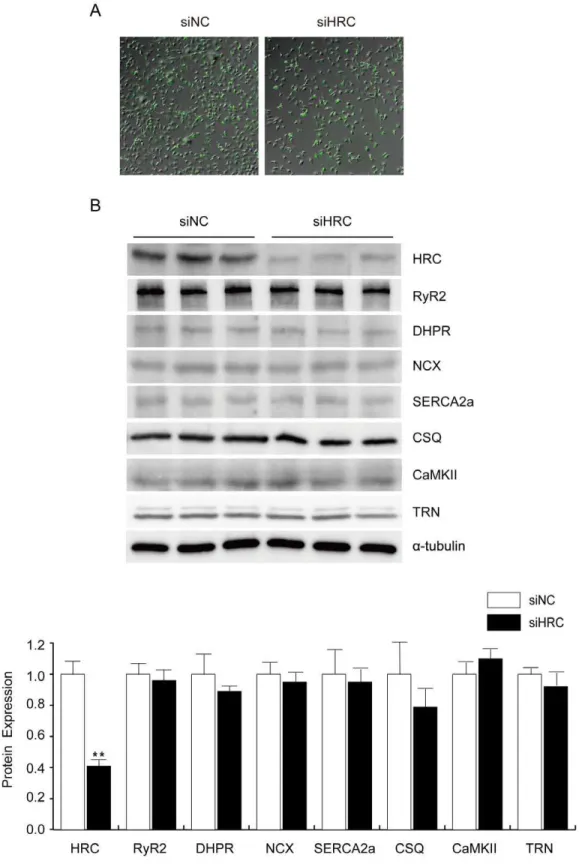 Figure 1. siRNA-mediated HRC knock-down (KD) and the expressional profiles of SR proteins in the control and KD samples