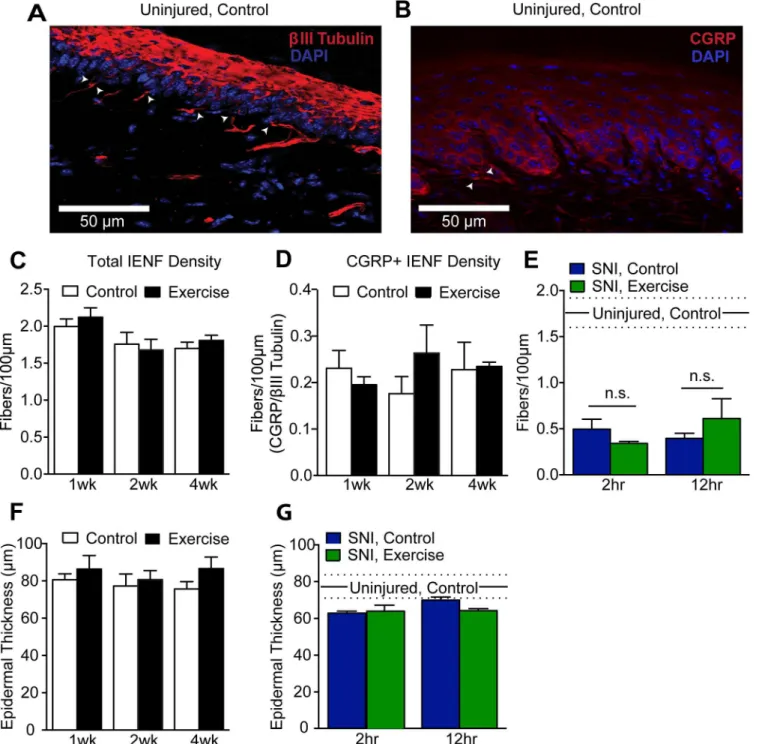 Fig 6. Exercise training did not alter hindpaw epidermal innervation or thickness in uninjured or SNI animals