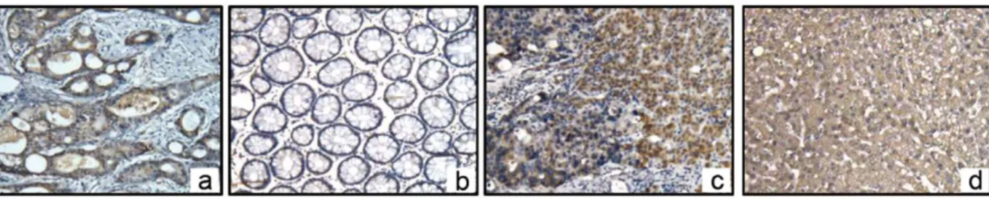 Figure 3. Expression of integrin av and CD44v6 in normal hepatocytes with Immunohistochemistry