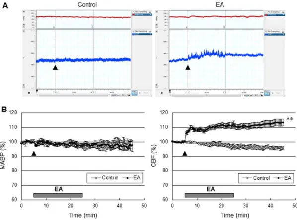 Figure 2. EA at Baihui (GV20) and Dazhui (GV14) increased cerebral perfusion in the cerebral cortex, not blood pressure