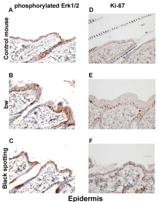 Fig 10. Expression of phosphorylated ERK1/2 and Ki-67 in the epidermis. Immunohistochemical analysis of the epidermal regions taken from the control transgenic mouse (A, D), the bw mouse (B, E), and the white coat area of the black spotting mouse (C, F) fo