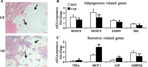 Figure 2. Browning of mammary fat from breast tumors and benign lesions. (A) Quantitative RT-PCR analysis of mRNA expression of fat browning-related genes: UCP1, PRDM16, CIDEA, COX7A1, PGC1a, TMEM26 and TBX1 (mean6SEM; n = 30; *P,0.05, **P,0.01)