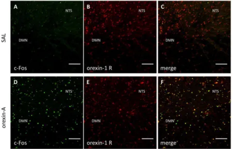 Figure 4. Co-localization of c-Fos and choline acetyltransferase (ChAT) after intrahypothalamic administration of orexin-A in the medulla oblongata