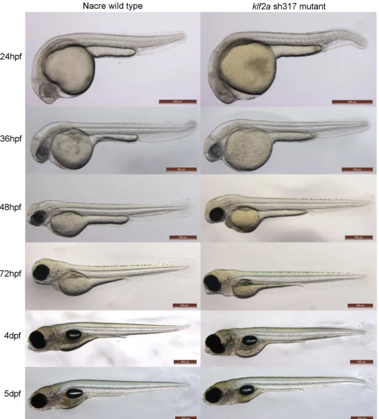 Fig 3. Comparison of the morphology of wildtype and klf2a sh317 mutant embryos. There are no obvious morphological differences between wildtype and klf2a sh317 mutant embryos up to 5dpf and also beyond up to adulthood (not shown)