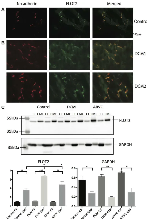Fig 5. Flotillin-2 shows increased ID expression during cardiac disease. (A) Immunofluorescence imaging of N- N-cadherin and flotillin-2 in human left ventricular tissue