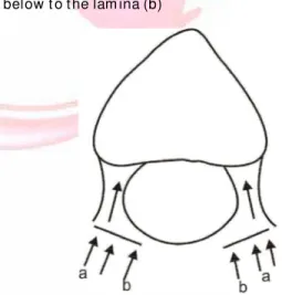 Fig.  4:   Diagram m at ic  represent at ion  of  a  t ypical  t ho- ho-racic vert ebr a seen from  above