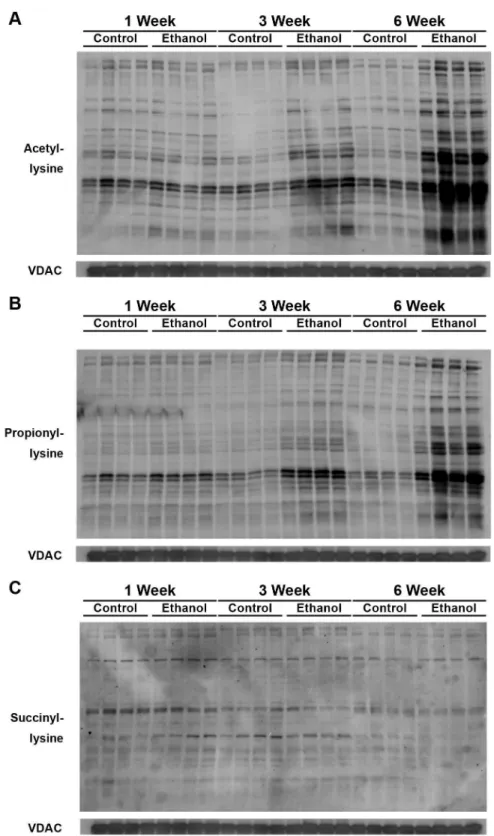 Figure 4.  Mitochondria were collected from livers of wild-type mice fed a standard or ethanol diet for 1, 3, or 6 weeks and  analyzed  for  total  protein  acetylation  (A),  propionylation  (B),  and  succinylation  (C)  by  western  blot  analysis  with