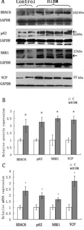 Figure 5. Immunoblots and relative mRNA levels of VCP and linkers between UPS and autophagy in control and GNE myopathy muscle biopsies