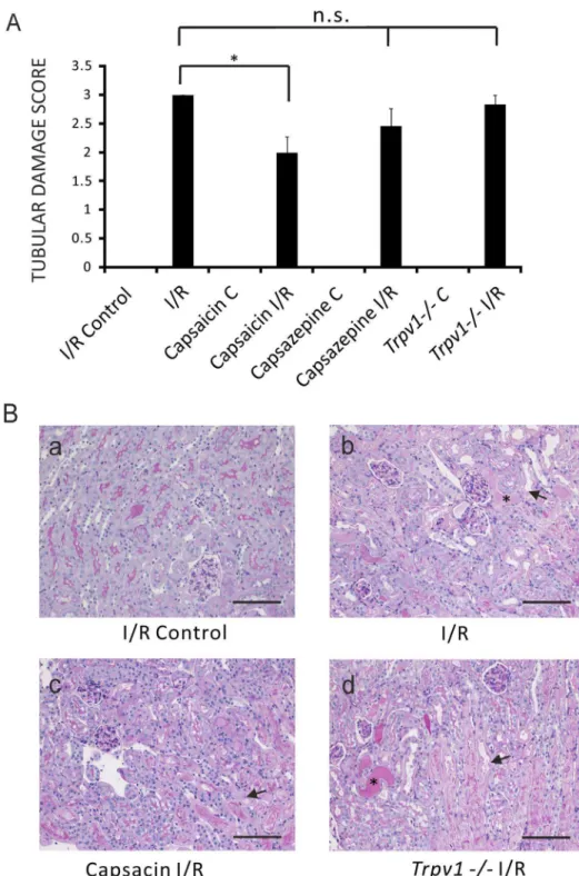 Figure 2. Amelioration of tubular damage score of I/R-induced AKI by pretreatment of mice with capsaicin, but not with capsazepine or genetic ablation of TRPV1